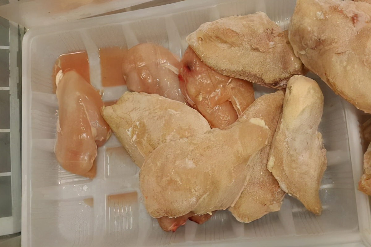 胆囊息肉，饮食要注意什么？医生给你讲讲，照着吃不会错