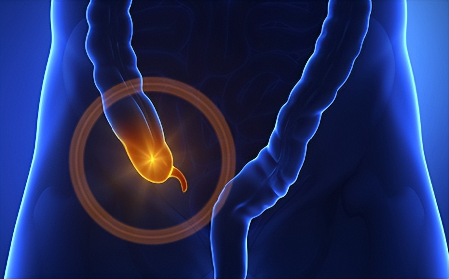 13岁男孩急性阑尾炎,腹型紫癜误诊为阑尾炎