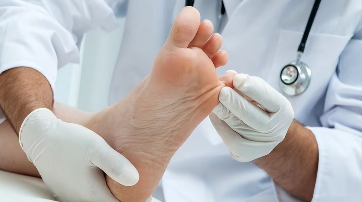 真菌感染怎么预防,足部真菌感染怎么解决