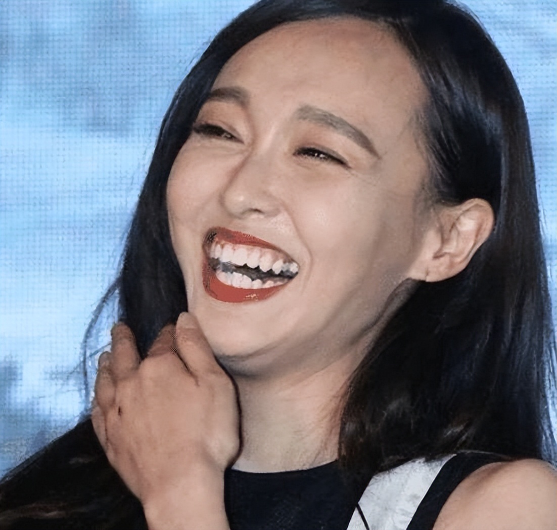 比“牙黄”更可怕的是“牙龈外露”，一笑就破功，很多明星都中招