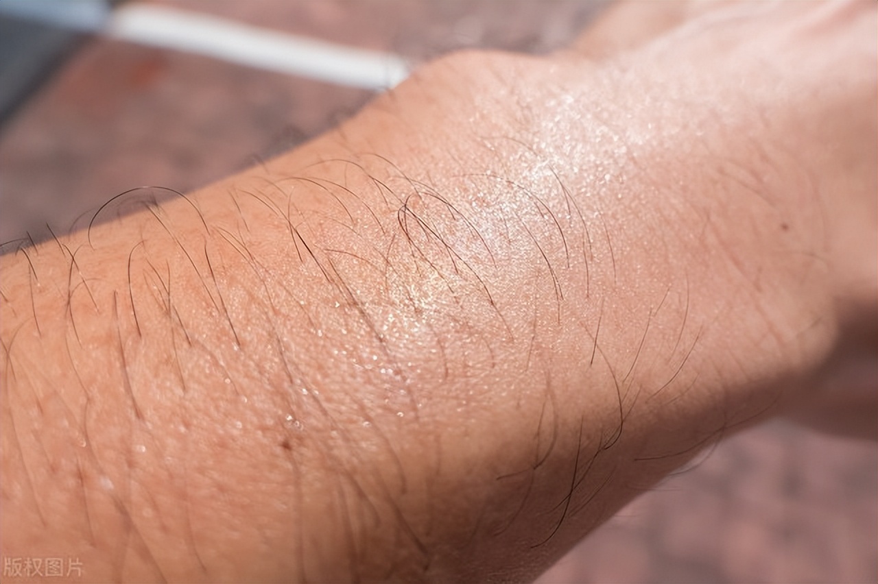 为什么头发有些是直的有些是卷的,眉毛卷起来上翘怎么回事