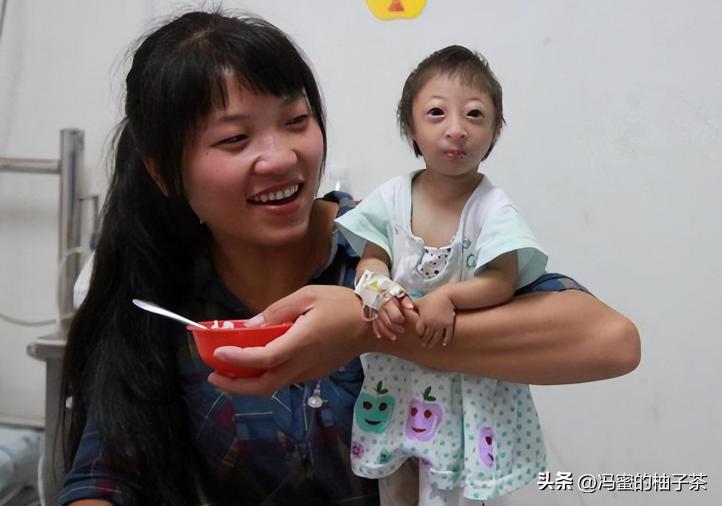 2009年湖南女子生下重2斤小猴子,湖南女子生了个小猴子上综艺节目