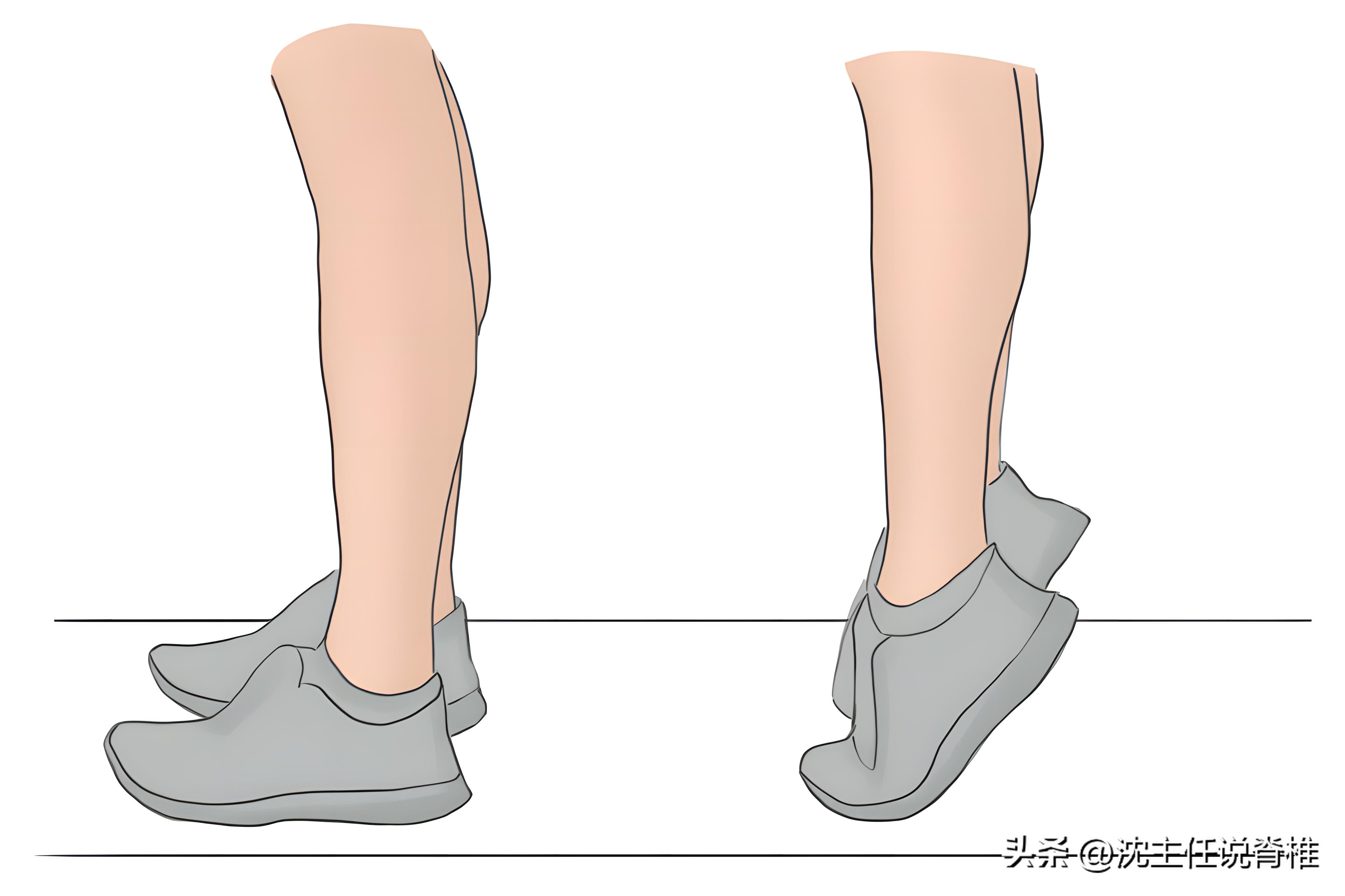 长短腿自测及改善方法,真假长短腿矫正训练动作