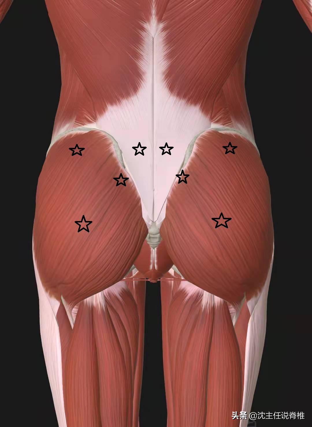 腰骶痛是不是腰突,腰骶疼是腰间盘突出吗