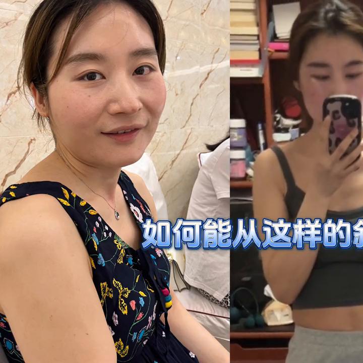 斜方肌问题症状,有关斜方肌的分析