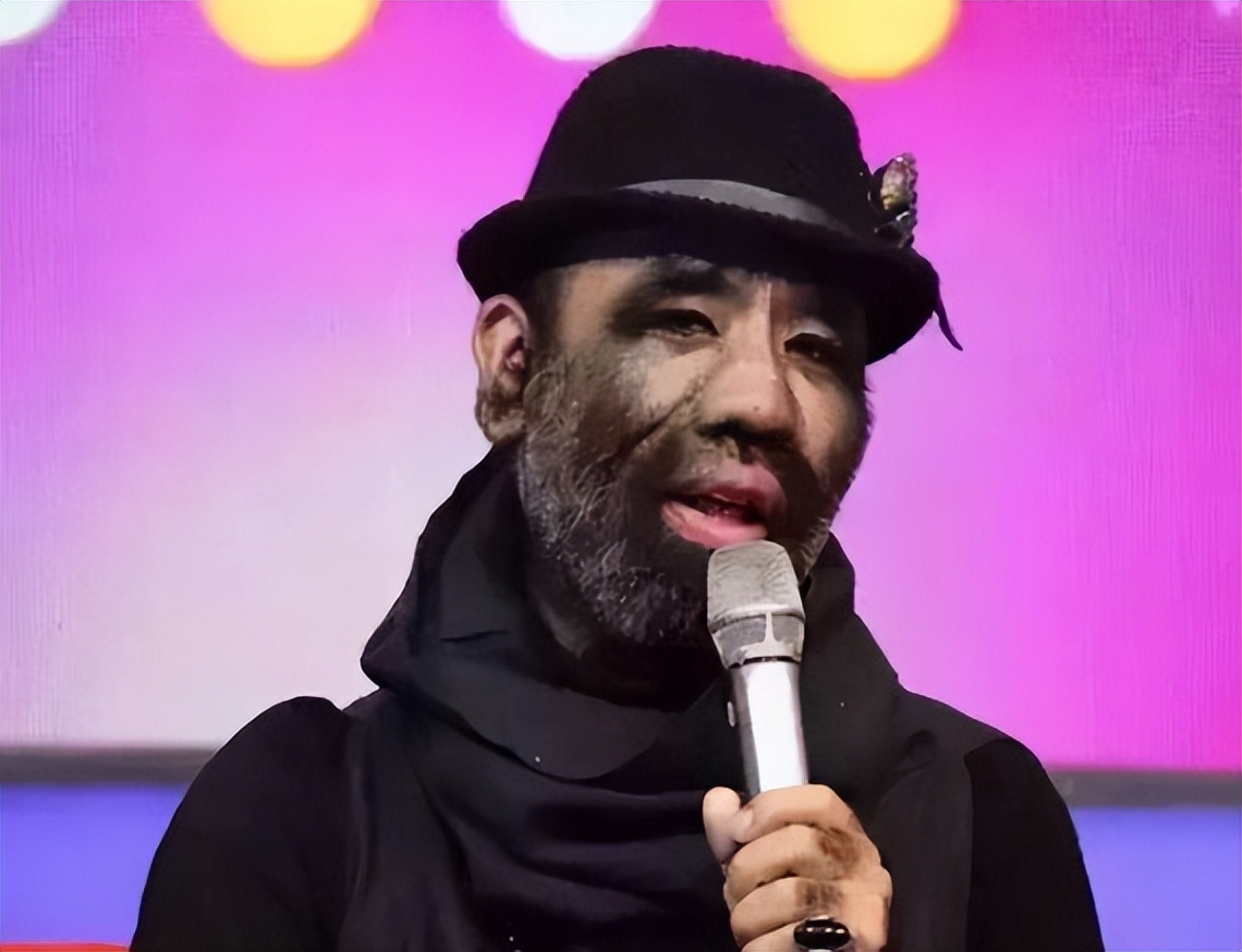 当年轰动一时的“毛孩”：42岁娶90后娇妻，生下一子未遗传长毛