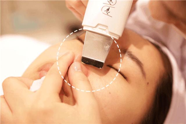 鼻头长黑粉刺怎么回事图片,鼻梁及两侧起了闭口粉刺