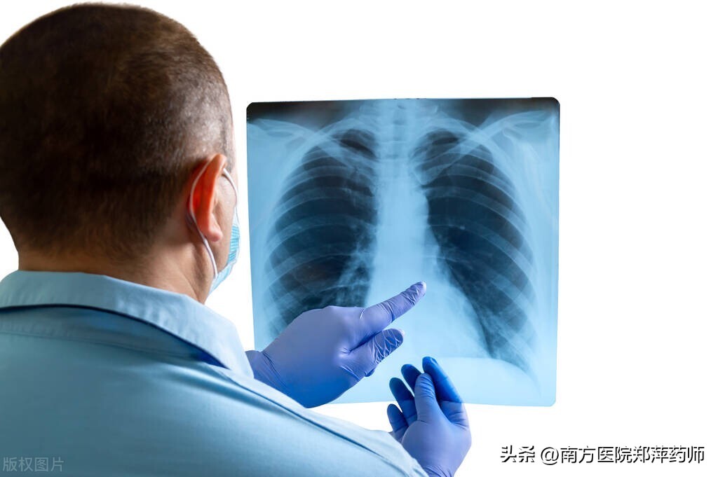 新冠病毒感染后咳嗽了怎么办,新冠咳嗽有痰了是好转了还是重了