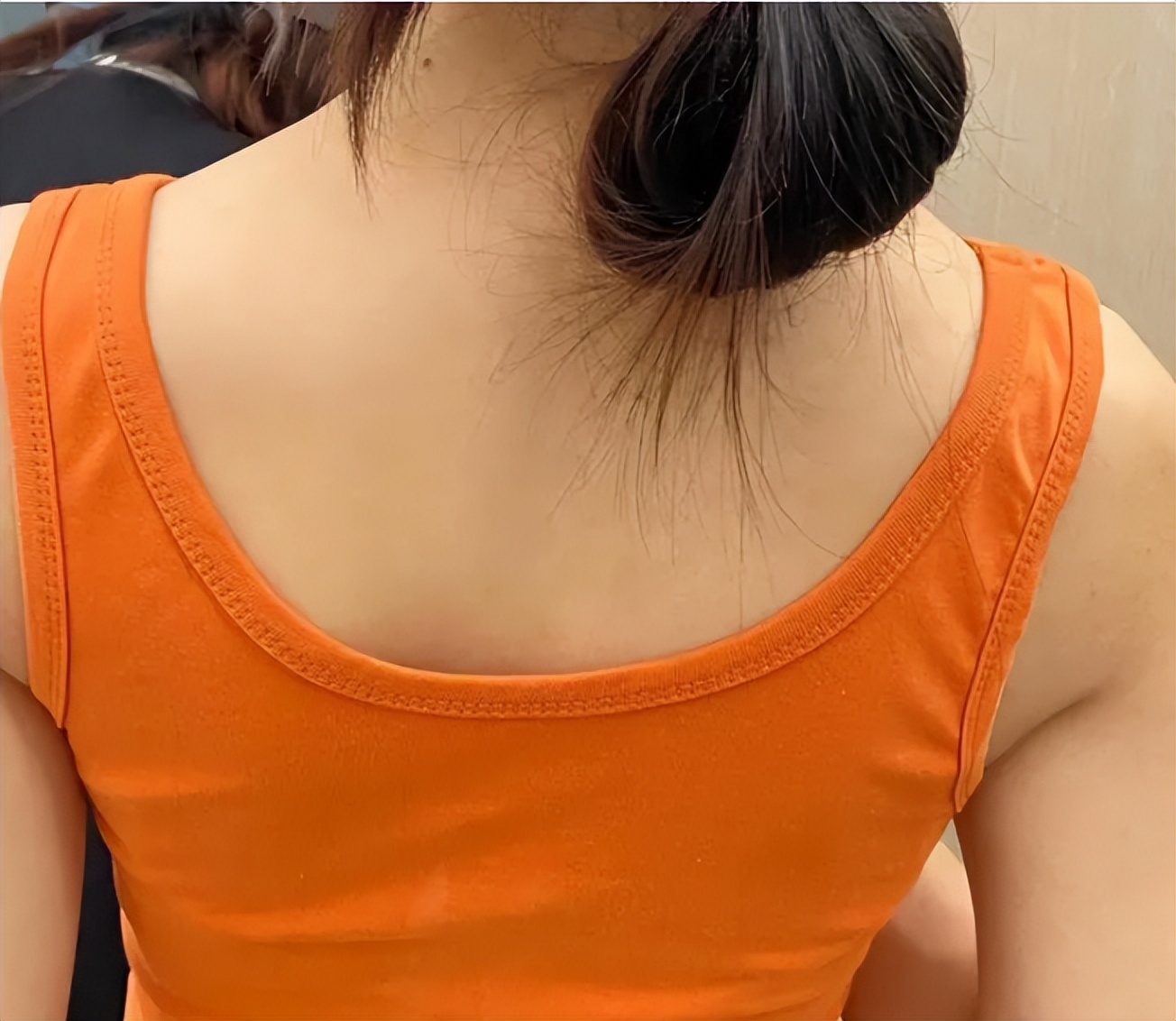 脓包型痘痘祛痘,满脸痘痘痘印痘坑去哪看