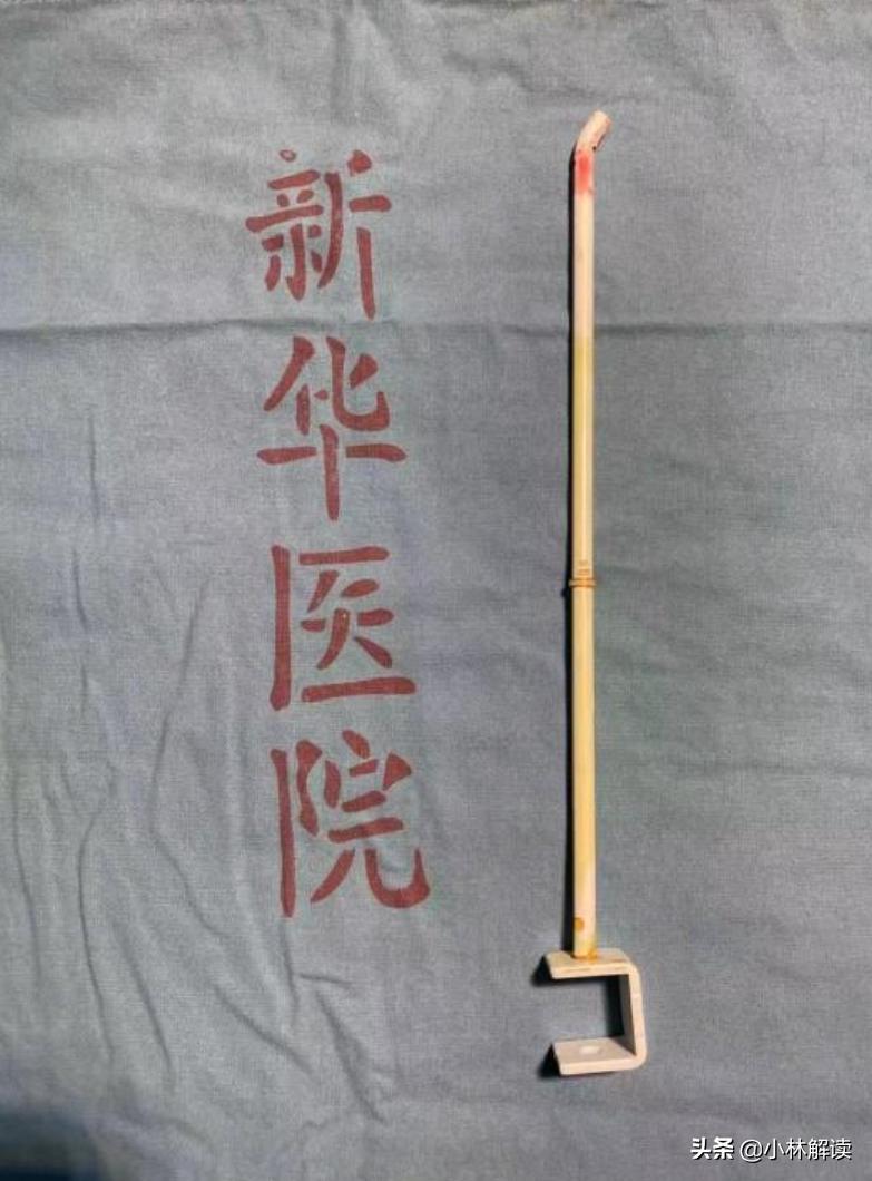 21岁女孩被人贩子插进10厘米钢钉,小女孩逛商场摔倒被铁棍刺入大脑