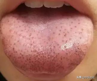 治脾不治肝,养肝疏肝调理脾胃的中成药