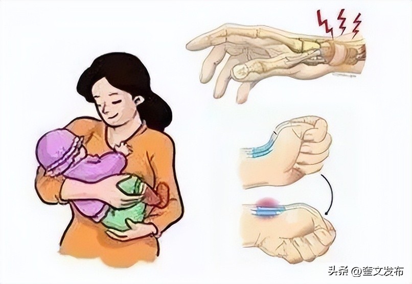 月子常见的28种月子病,坐月子10大禁忌月子病怎么治