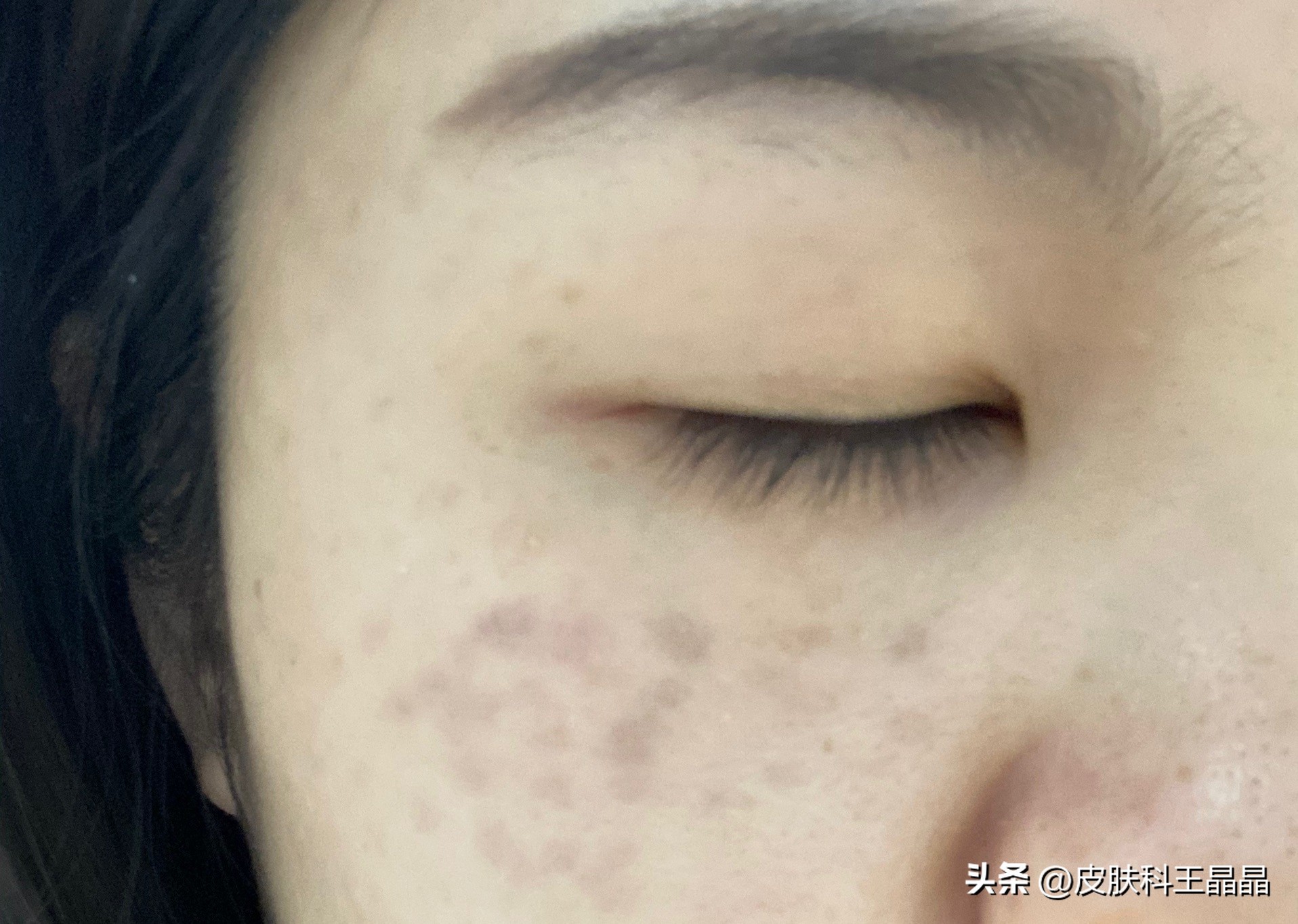 色斑用任何方法都祛不掉怎么办,色斑应该治吗