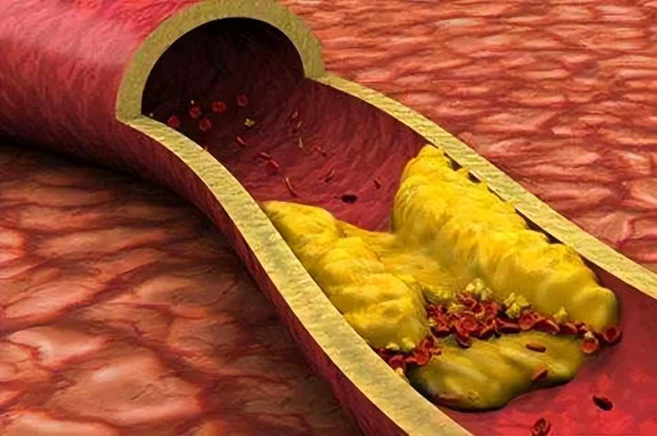 “中药”逍遥丸，除了调理肝郁脾虚，还可改善4种病，不妨了解下