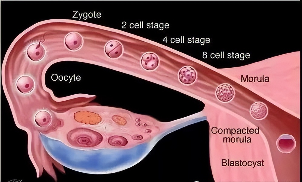壶腹部宫外孕原因,宫外孕的原因在男在女