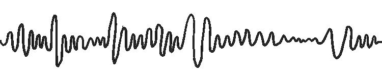 体检查出来的“窦性心动过缓”是病吗？别慌，马上给您解释清楚