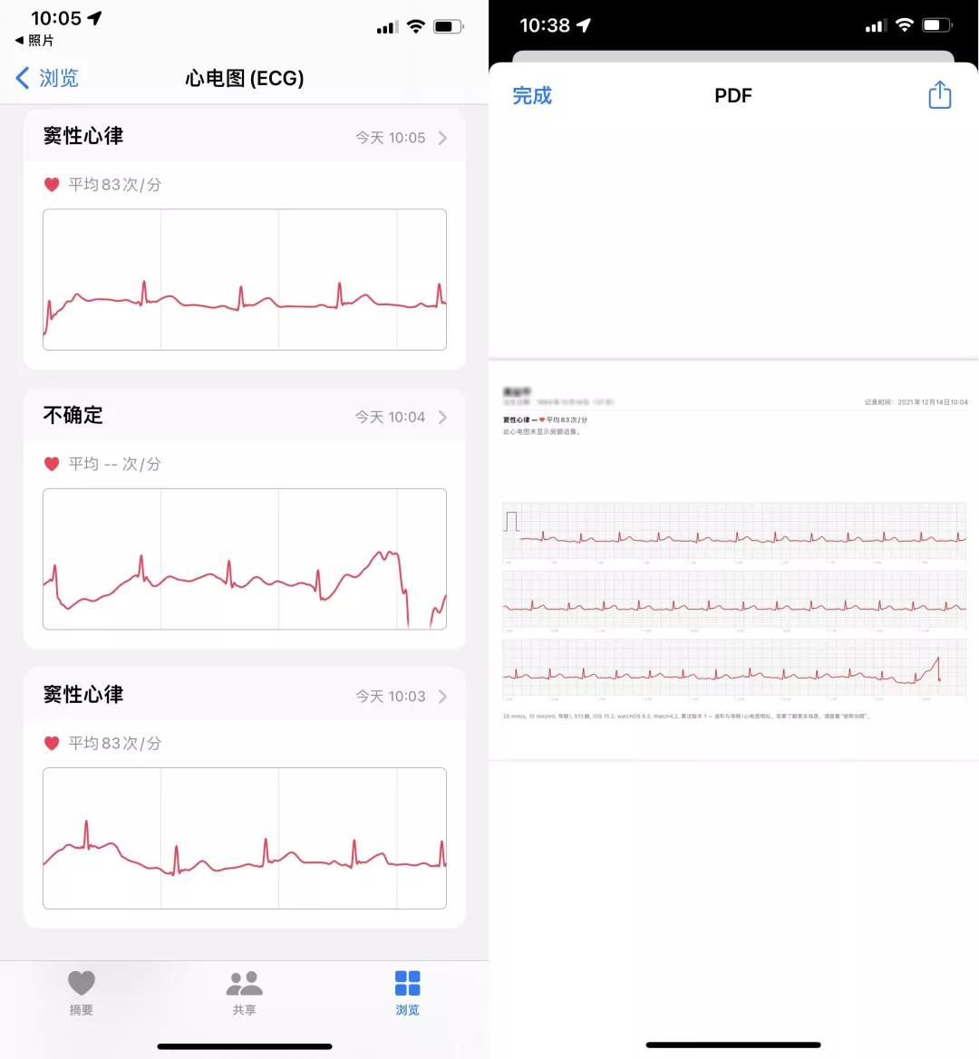 外版的applewatch有心电图功能吗,applewatch心电图有几个功能