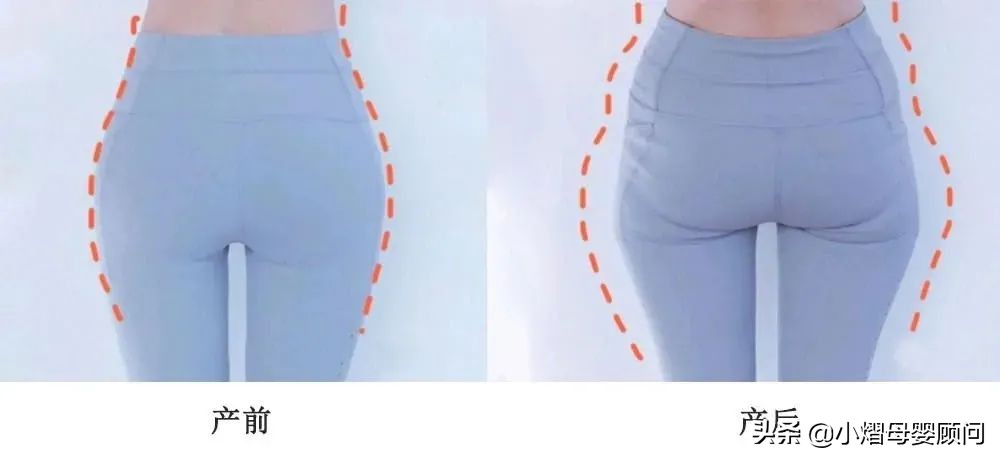 生完孩子盆骨变宽怎么恢复,生完孩子屁股变宽怎么恢复