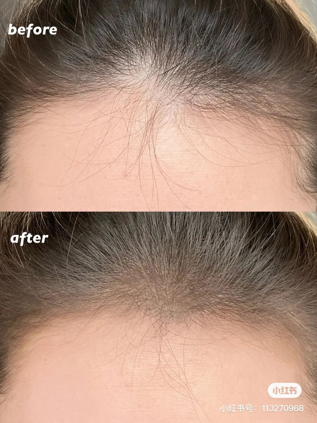 女生为了变美到底有多假动漫版,女生为了变美做整容手术