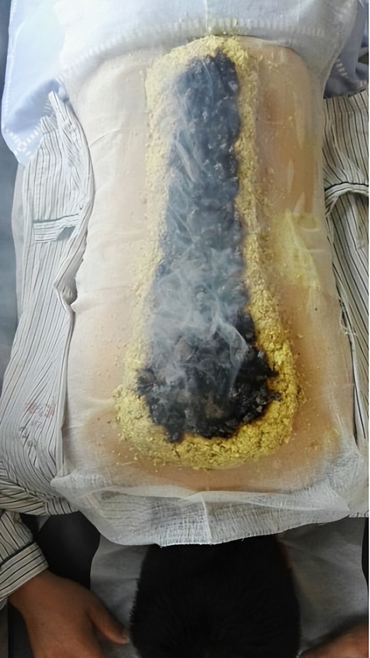 狂飙安欣受伤旧疾复发住院,狂飙安欣去医院