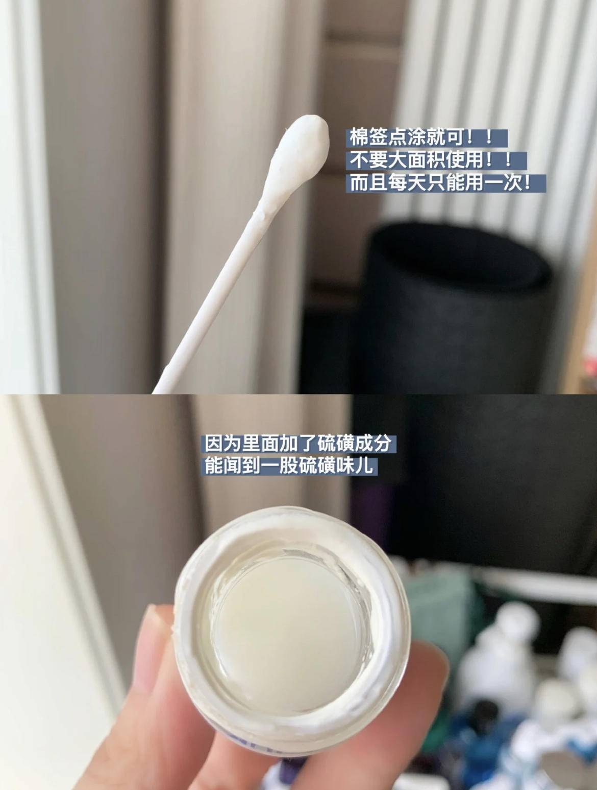 假期治痘最佳时期,如何快速消除熬夜痘