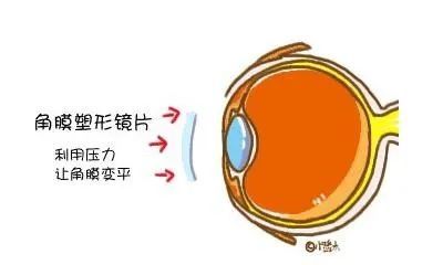 进口清关案例,眼镜进口报关相关操作流程