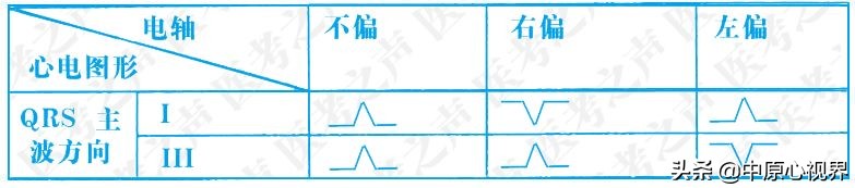 护考几种常见的心电图,常见的心电图图形分析
