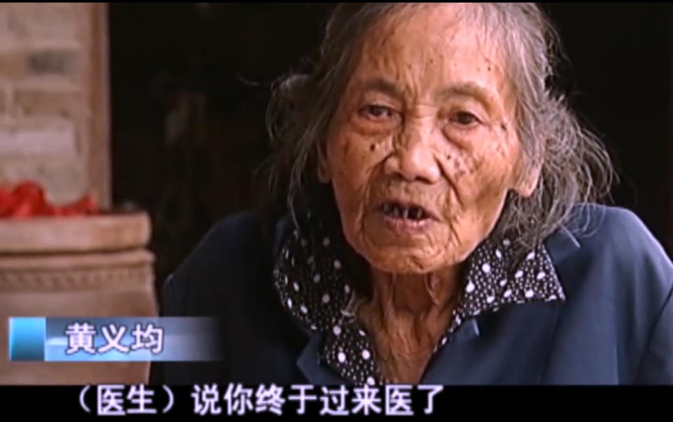 2007年四川90岁老妇，腹中怀子60年未生，后检查发现胎儿没有腐烂