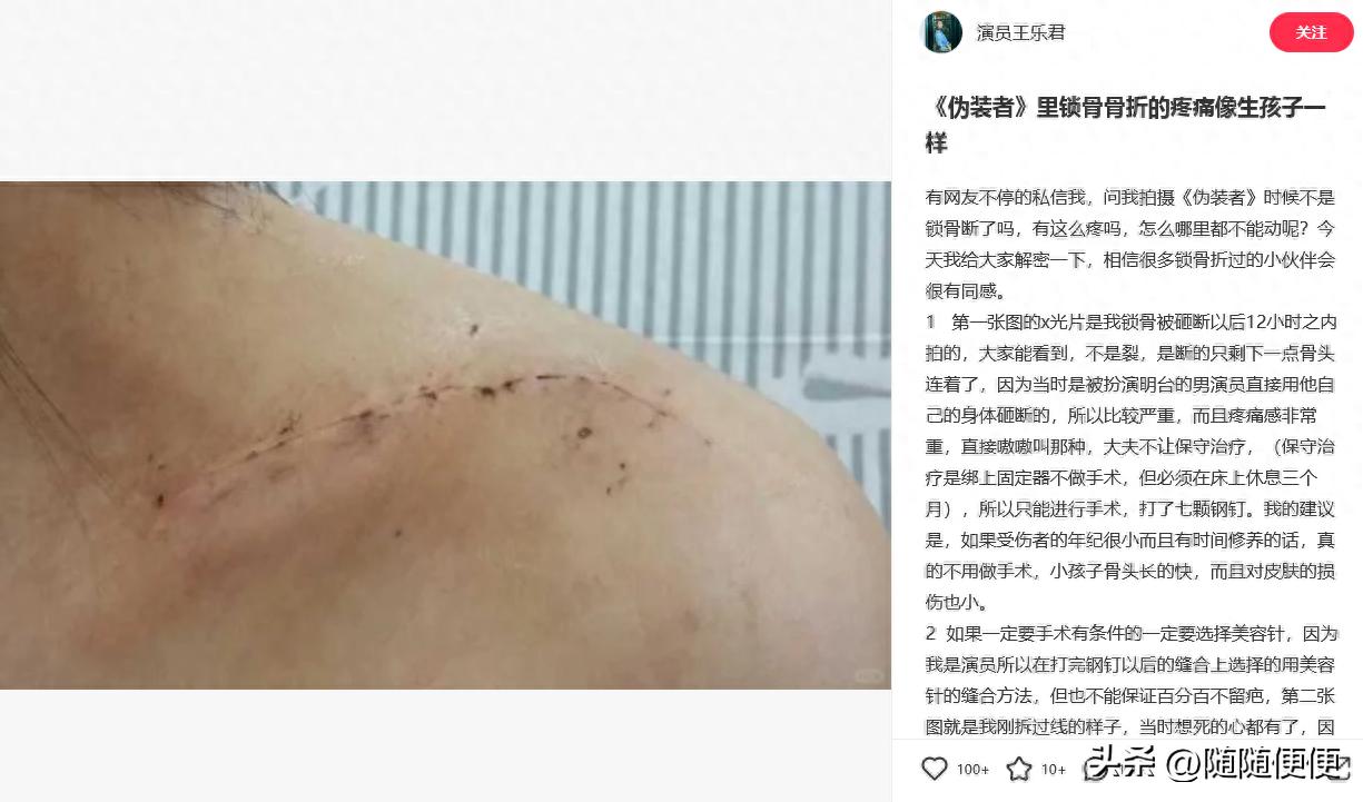 女演员拍戏被勒脖子,女演员被勒住脖子演戏