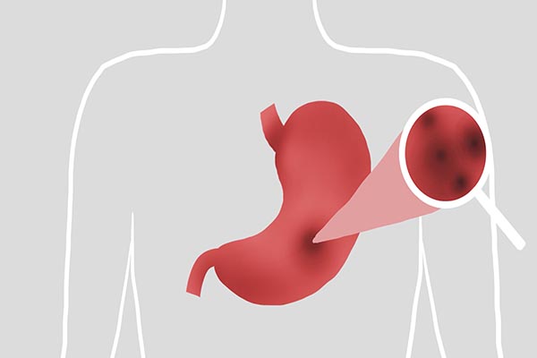 胃不好熟洋葱可以吃吗,胃不好洋葱可以吃吗