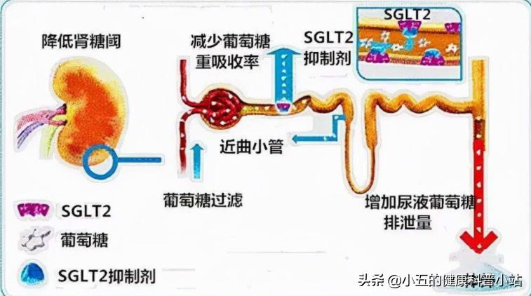达格列净对糖尿病肾病有好处吗,达格列净降糖对肾脏有影响吗