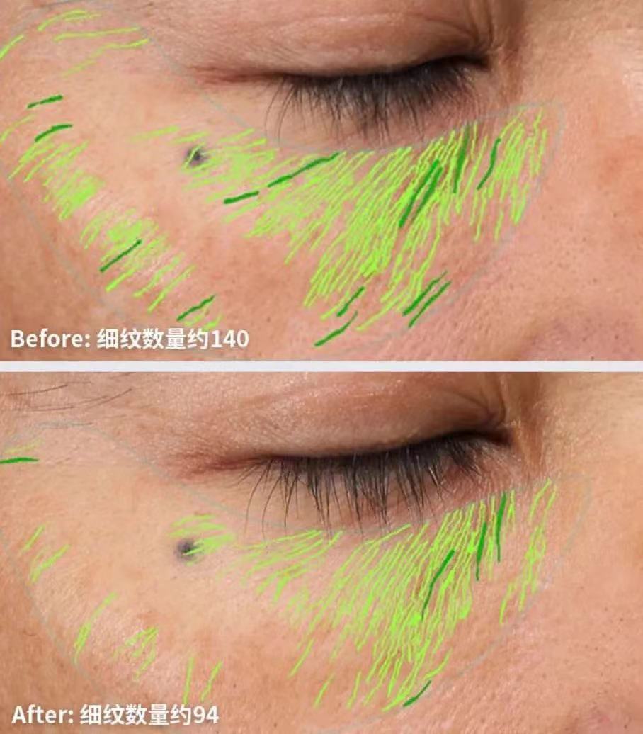 40岁最佳护肤品国货,40岁值得入手的护肤