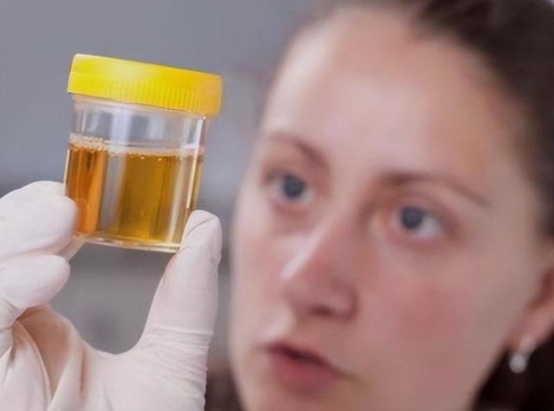 小便时泡沫多，除了肾不好，还可能与这3个原因有关，需了解