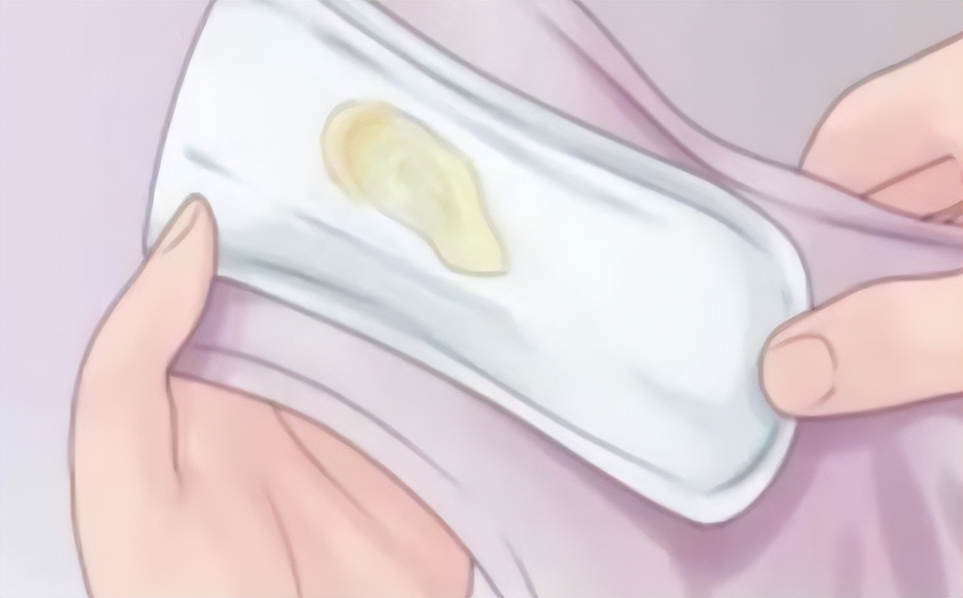 女性出现豆渣样白带是什么病,女性白带像豆渣一样是什么引起的