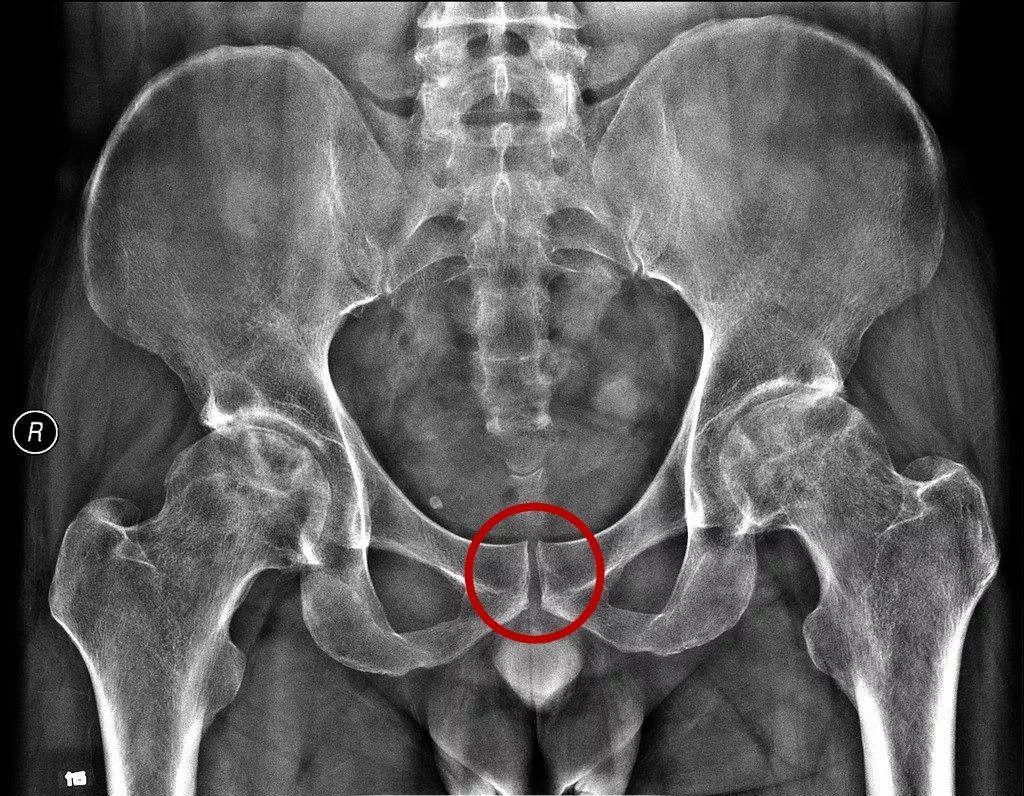 产后子宫修复避坑,瑜伽产后修复的十大坑