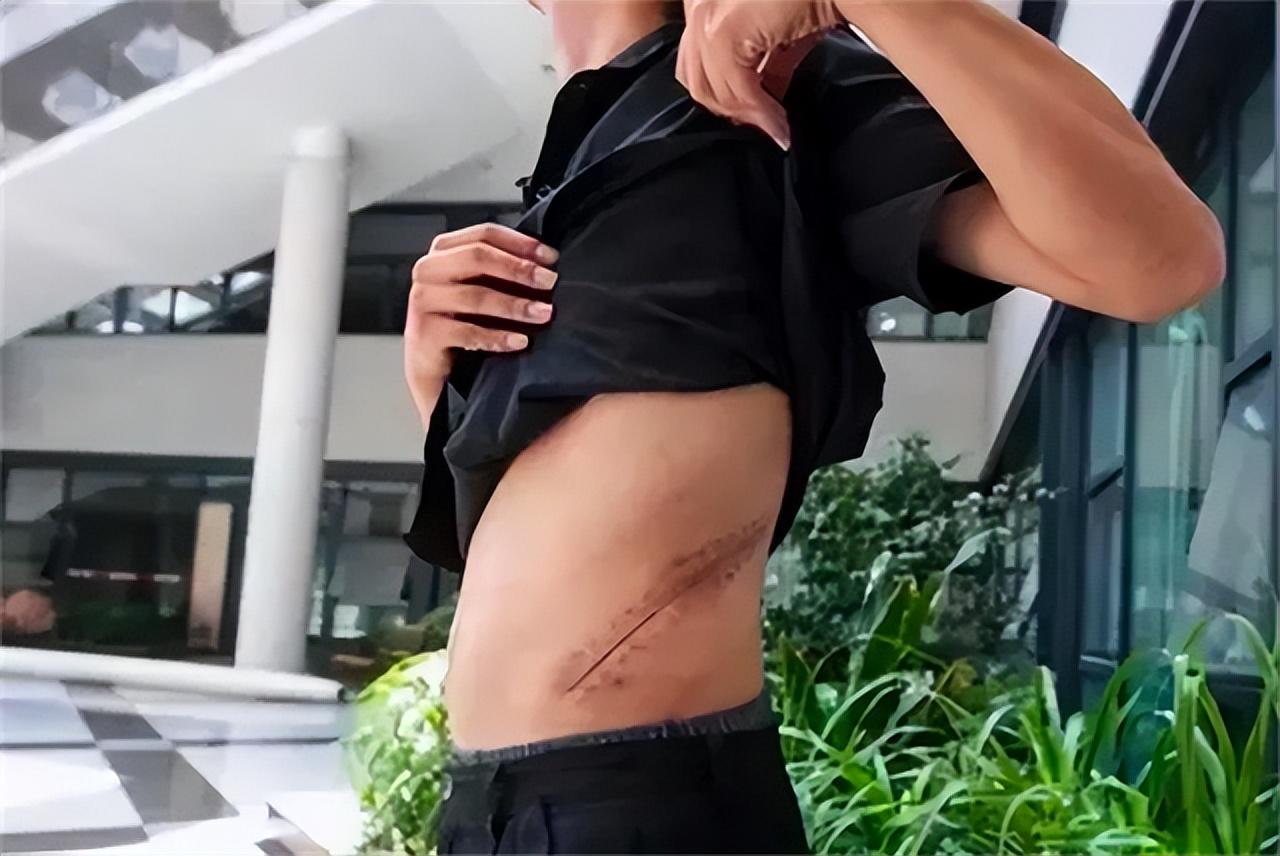 10年前为了苹果手机卖肾的男孩,10年前卖肾男孩现状