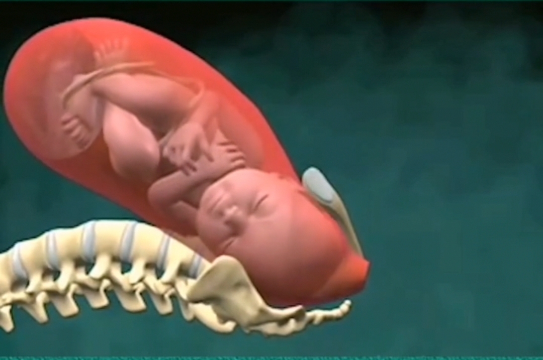 顺产和剖宫产哪个遭罪,顺产和剖宫产哪个身材恢复更快