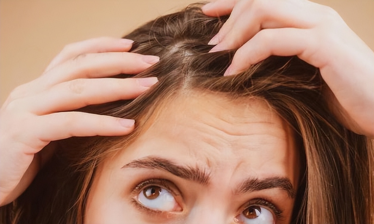 头皮上全是疙瘩大脓包是什么原因,头皮长疙瘩和脓包是怎么回事