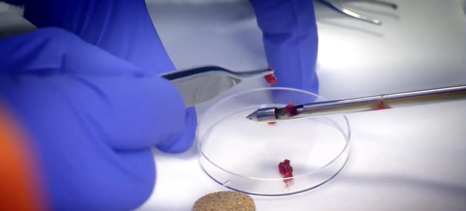 人类同类相食是怎么回事,人类基因有防止人吃人的吗