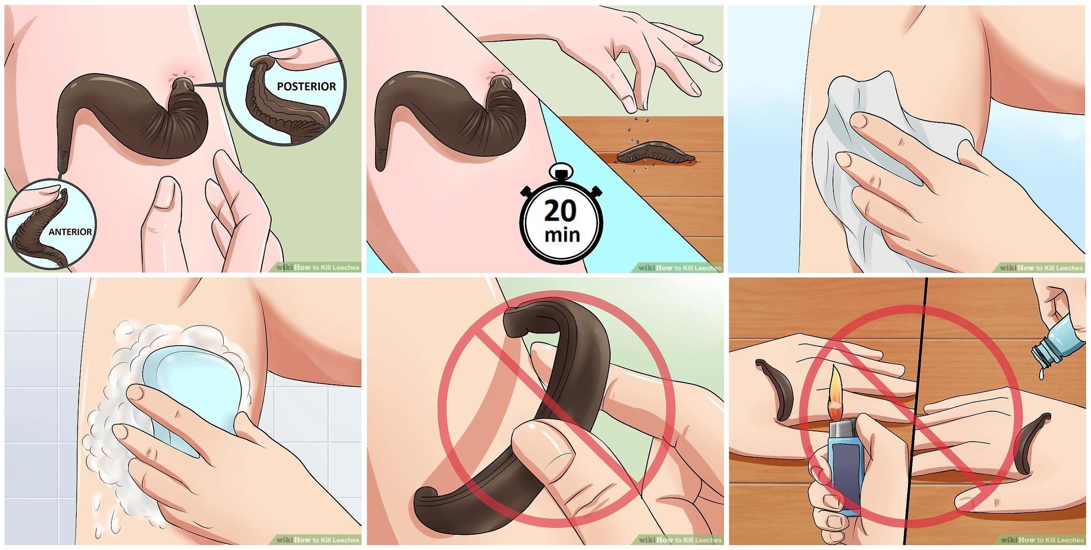 民警巡逻后身上清除蚂蟥,西藏民警巡逻被35只蚂蝗咬伤