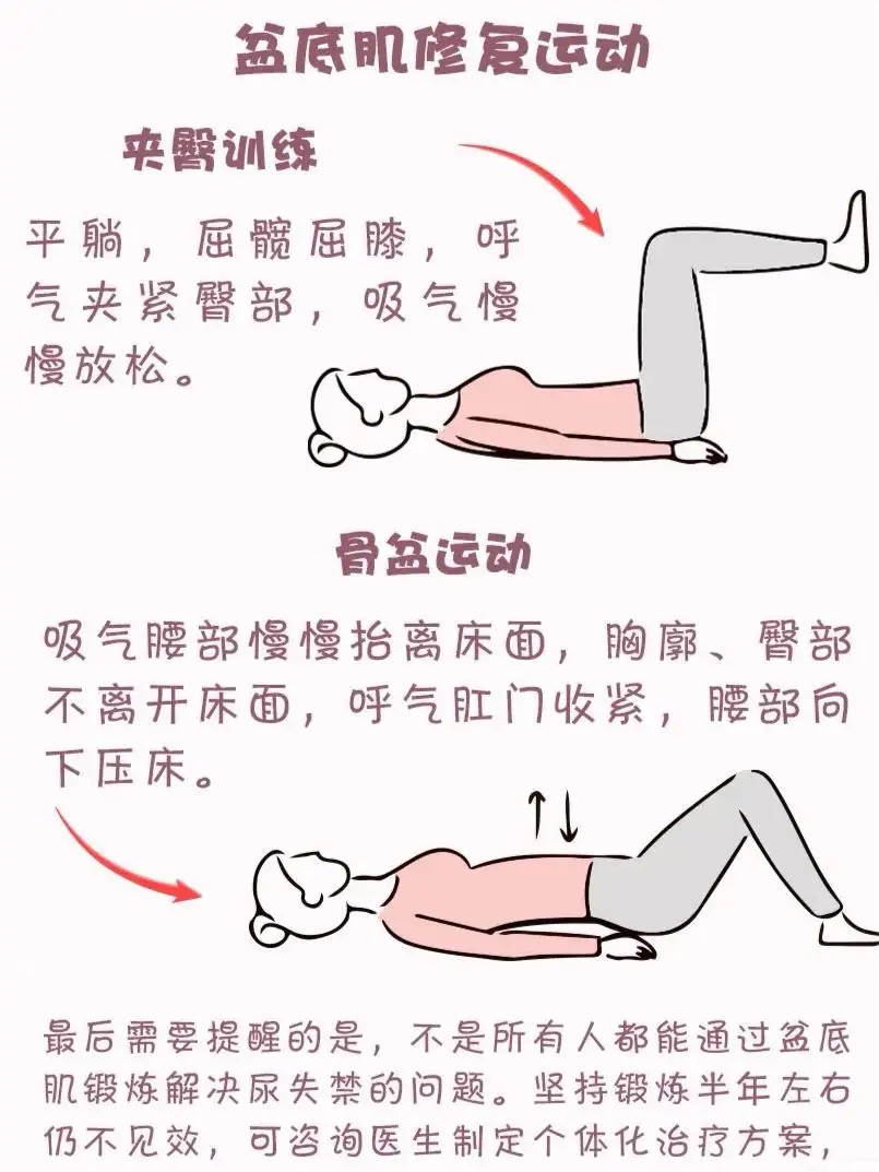 产后漏尿多长时间可以锻炼修复,产后漏尿的调理手法