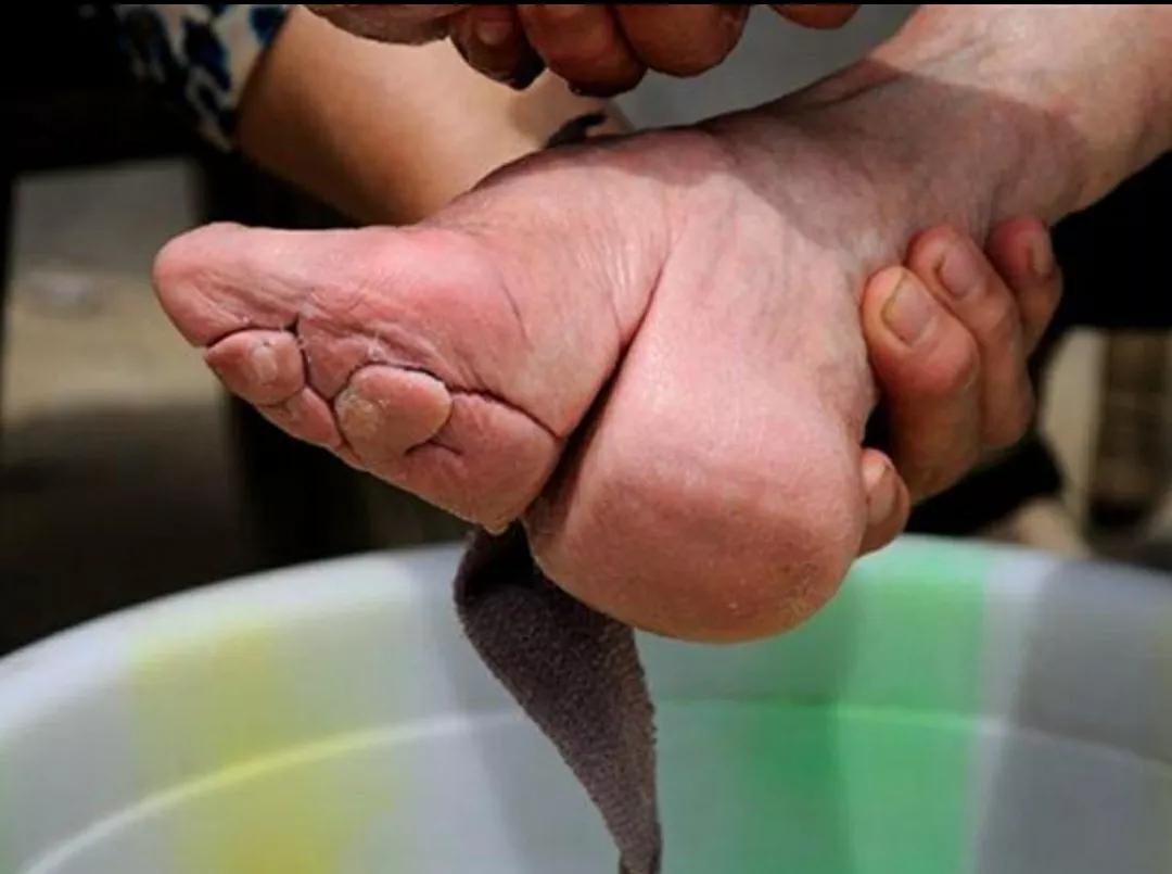 由某网店售卖“贞操锁”印花女裤想到男权之下女性的悲惨命运