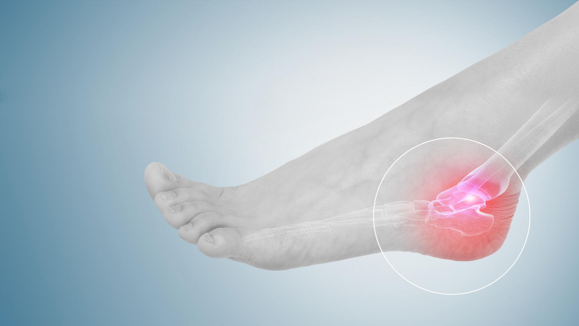 70多岁老人脚后跟麻是什么原因,老人早上起床脚后跟疼是怎么回事