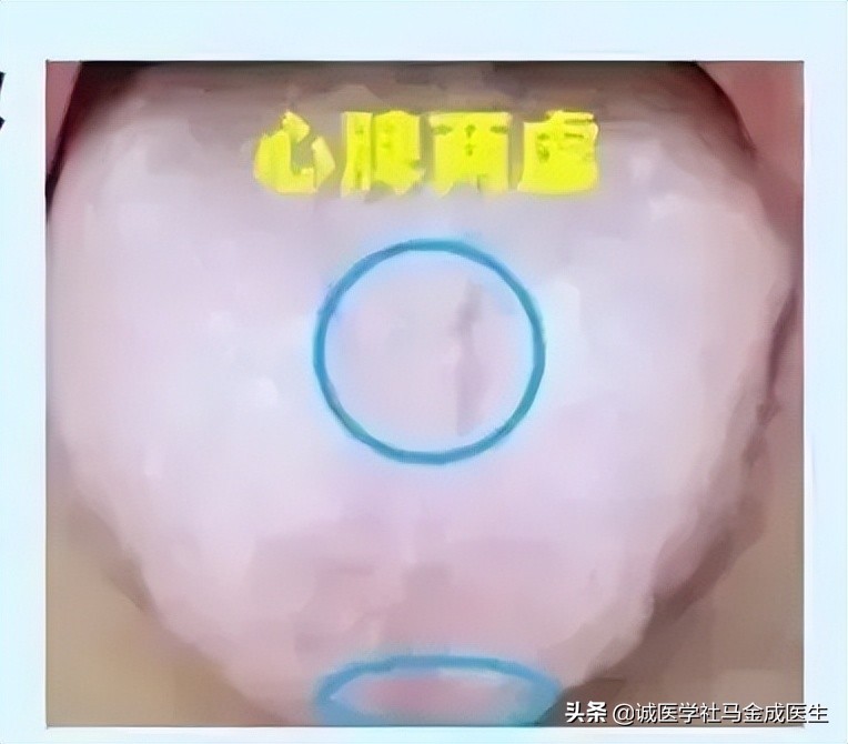 5岁小孩脾胃差吃什么中成药调理,脾胃肝肾肺亏损全部调理的中成药