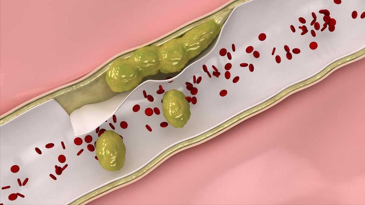 老人经常打吊针对身体有什么危害,84岁老人打疏通血管的吊针有用吗