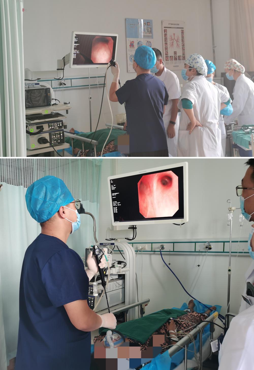 普通支气管镜和无痛支气管镜,无痛支气管镜检查清醒后难受吗