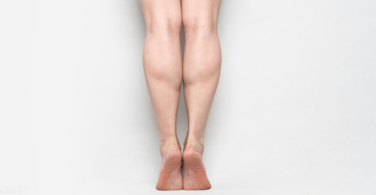 中年大叔每天踮脚多少次,每天踮脚尖20分钟血管还堵吗