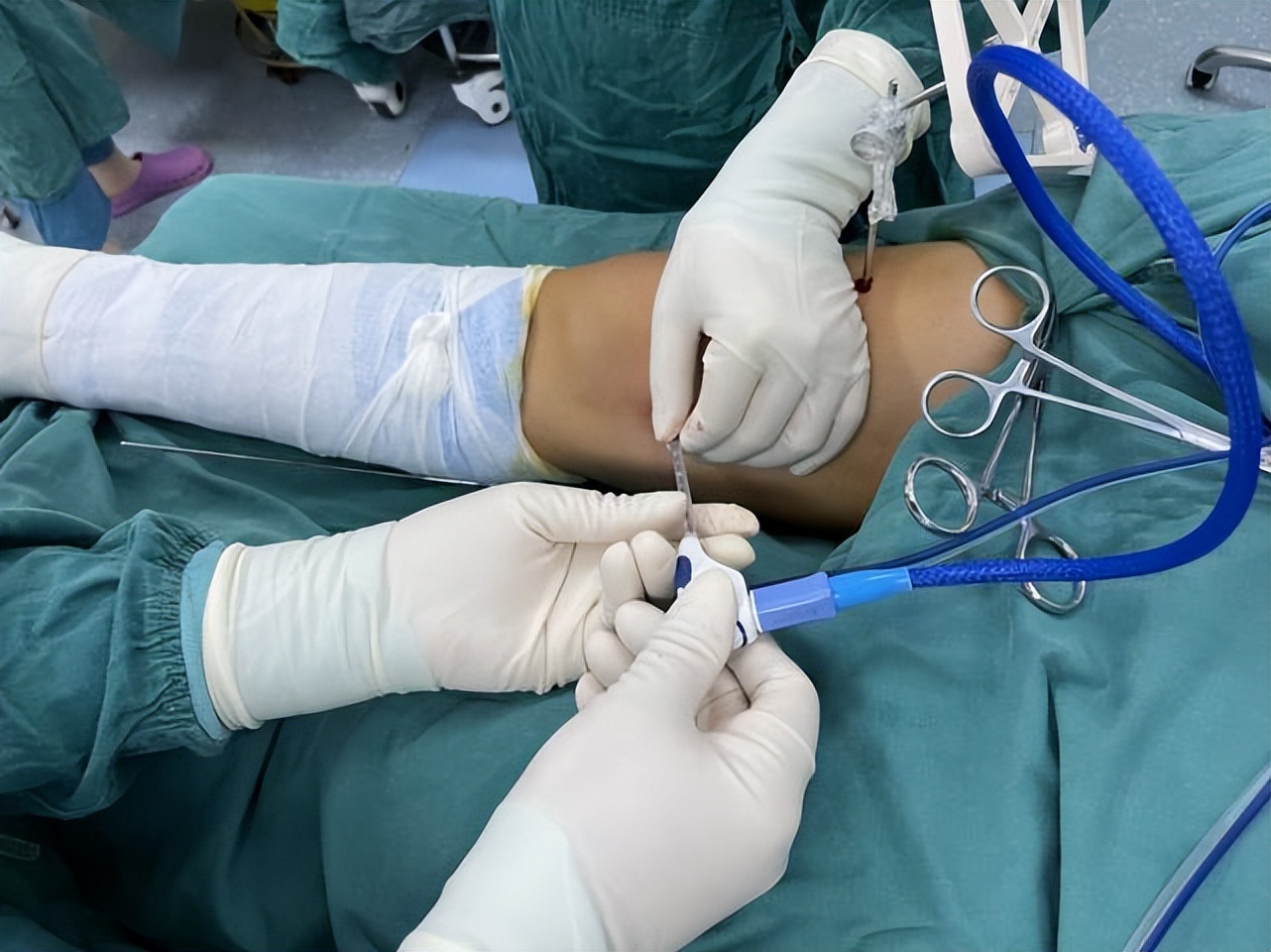 西安市红会医院康复疼痛科,西安红会康复疼痛科