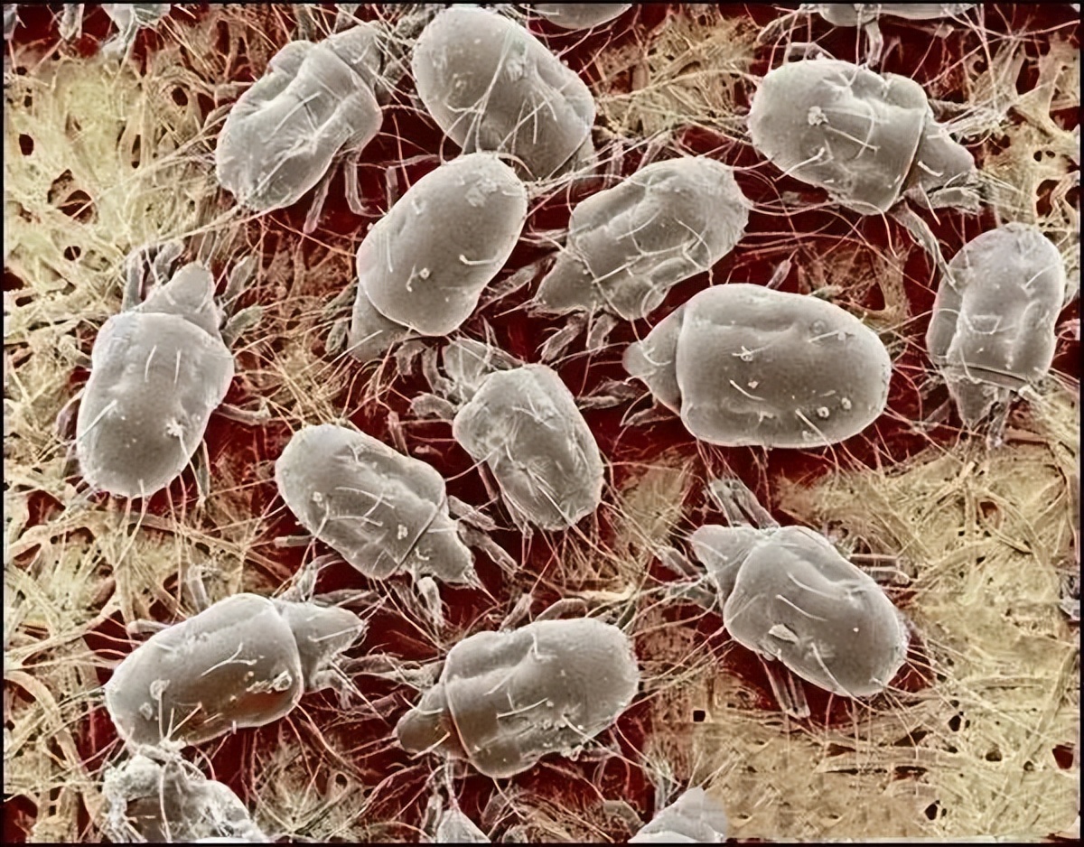 怎么对付螨虫的最好方法,如何正确的去处理螨虫