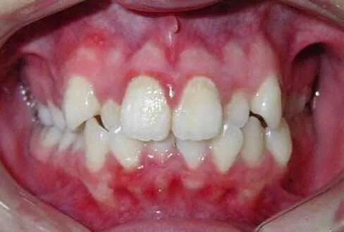 牙满分,牙满分怎么样